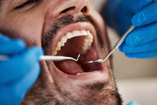 Best Urgent Tooth Repair  in Crane, MO